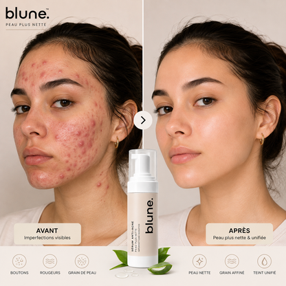 BLUNE™ | Votre Rituel Anti-Imperfections Quotidien