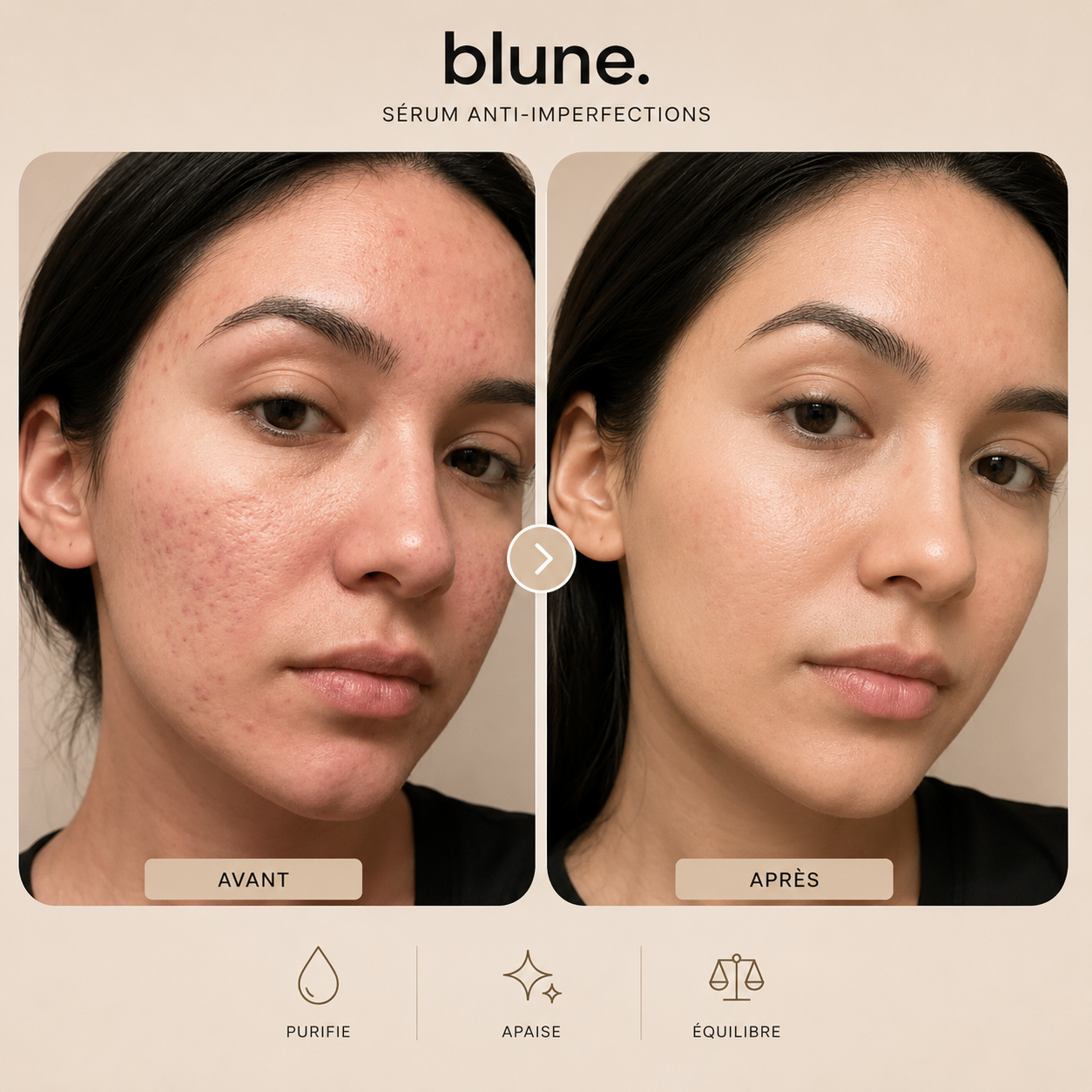 BLUNE™ | Votre Rituel Anti-Imperfections Quotidien