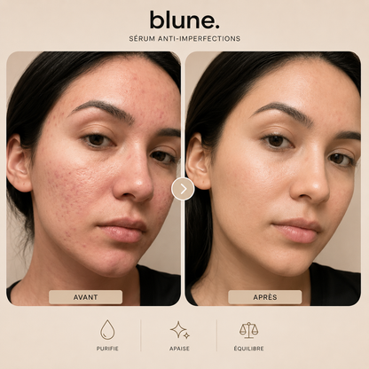 BLUNE™ | Votre Rituel Anti-Imperfections Quotidien
